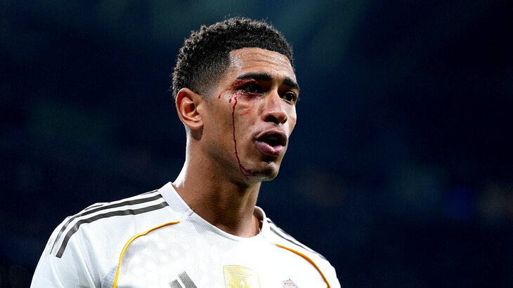 Окровавленный Джуд Беллингем